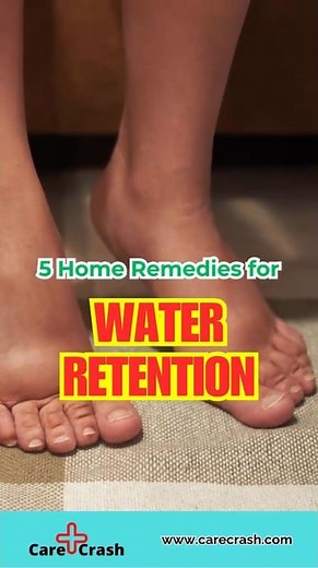 5 Effective Water Retention Home Remedies | #carecrash