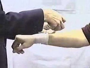 Reverse Spiral Bandage