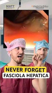 High yield fasciola hepatica facts for your medical exams
