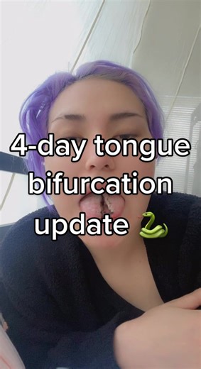 #fyp #fypシ #bodymodification #bodymods #splittongue #tongue #tonguesplit #piercing #viral #bifurication #alt #update