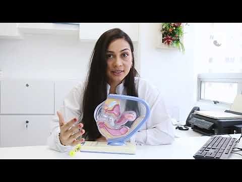 Fertilización in vitro paso a paso ¿cómo se hace?