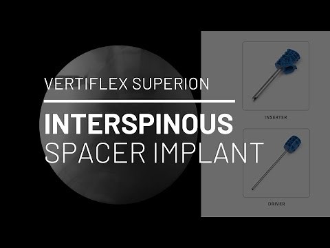 Vertiflex Superion Interspinous Spacer Implant