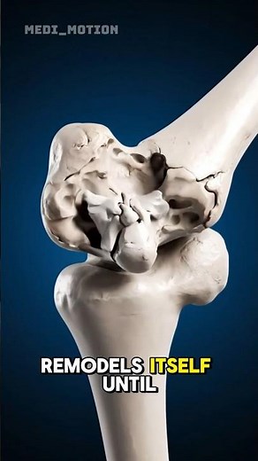 How Broken Bones Heal? 🦴 (3D Animation)