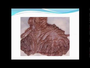 Peste des petits ruminants/PPR/Ovine rinderpest ppt