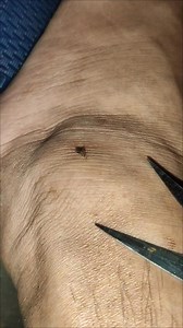 How I Protect My Legs from Mosquitoes! . . . . . . #mosquito #mosquitoes #mosquitobites #mosquitorepellent #mosquitokiller #mosquitos #mosquitocontrol #culicidae #Protection #SummerVibes | Lexus Pet Boutique