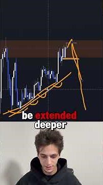 This London Session Model is so easy to spot