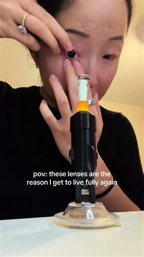 who knew this tiny medical device could give me my life back #scleralenses #contactlenses #stevensjohnsonsyndrome #dryeyes #optometry
