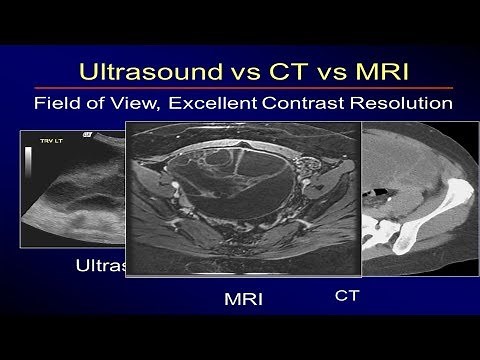CT Scan Vs MRI Vs Ultrasound, Which one is better?
