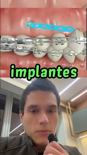Dá para puxar dentes para trás sem extrair?