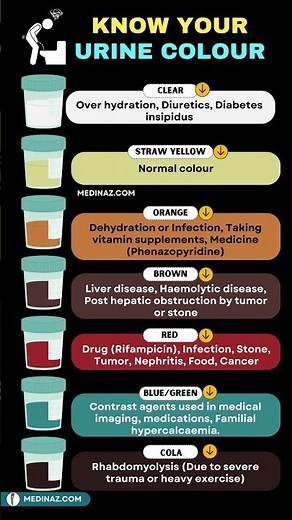 Colour of urine and what it means | Urine color | Red urine #shortsfeed #redurine #shorts