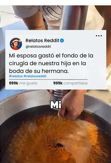 Parte 2 en el Perfil - Mi esposa gastó el fondo de la cirugía de nuestra hija en la boda de su hermana. #reddit #redditstories #redditespañol #español #historiasreales