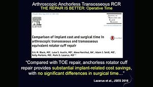 Arthroscopic Anchorless Transosseous RCR: Why Do We Still Use Suture Anchors?