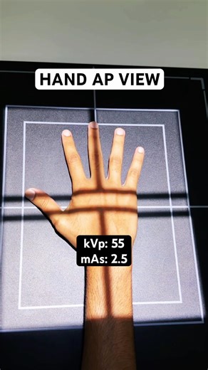 Hand X-ray: 🖐️🩻🦴 AP | Lateral | Oblique views Perfect positioning #xray #ap #lateral #xraytech