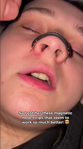 This nasal dilator will help you with your snoring problem