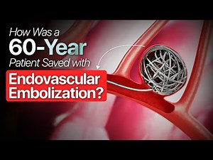 How We Saved a Patient With Sudden Internal Bleeding Using Embolisation | Dr Sagar Satpute | SLVC