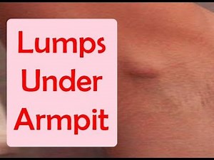 Home Remedies for Lumps Under Armpit | Lumps Under Armpit Treatment at Home