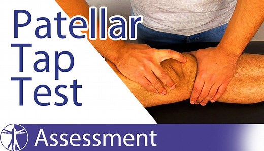 PATELLAR TAP / BALLOTTEMENT TEST FOR INTRA-ARTICLAR SWELLING The Patellar Tap Test is a tool to assess for intra-articular swelling of the knee joint. Being able to assess what kind of swelling you are dealing with, gives you an idea about where the lesion could be located in the knee. With extra-articular swelling (like in prepatellar bursitis or patellar tendonitis) the test will be negative. According to Kastelein et al. (2009) this test has a sensitivity of 83% and a specificity of 49% for t