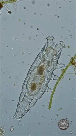 ‎This microscopic creature has a spinning mouth.‎#Rotifer #Microscope #MicroLife #microworld #shorts
