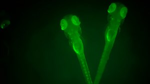 Nitroreductase/Metronidazole-Mediated Ablation and a MATLAB Platform RpEGEN for Studying Regeneration of the Zebrafish Retinal Pigment Epithelium
