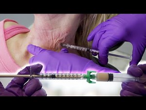 Non-Surgical Neck Rejuvenation with Hyperdilute Radiesse & PRF Injections