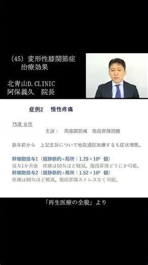 医療現場からの情報発信「再生医療の全貌」（45）変形性膝関節症 治療効果：「再生医療の全貌」幻冬舎講演より #再生医療 #医師が解説 #医療 #幹細胞 #変形性膝関節症