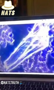 13 reactions · 34 shares | Non-vaccinated vs. vaccinated blood cells under a microscope. | The Rona Report | Facebook