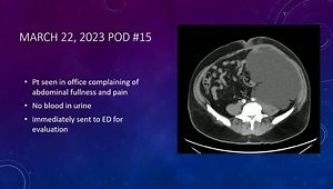 Confessions From Cases We Regret: Lumbar Arthroplasty