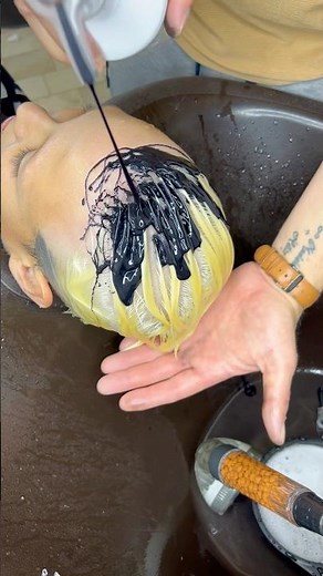 Revolutionizing NEVOU