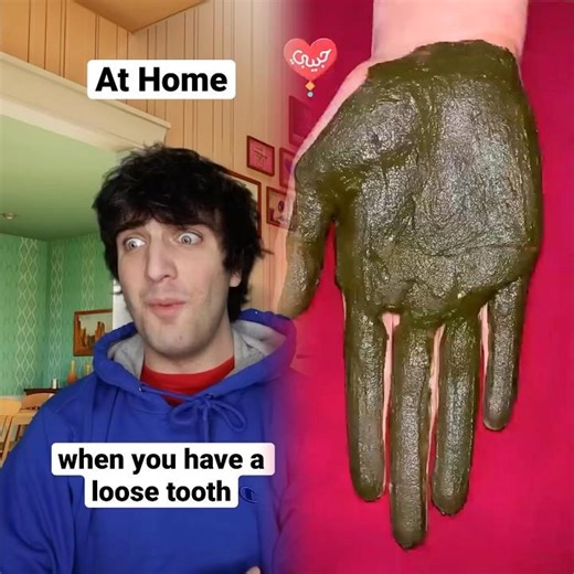 When You Have A Loose Tooth #shorts #relatable