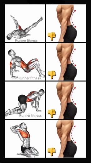 Anterior Pelvic Tilt Kaise Thik Karein? | Fix Your Posture in 4 Steps #backpainrelief