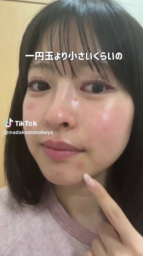 敏感肌に最適なスキンケア方法