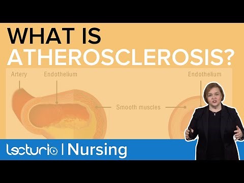Pathophysiology of Atherosclerosis (How does the Plaque Form?) | Pathophysiology | Lecturio Nursing