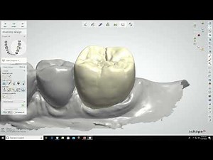 DIGITAL CROWN DESIGN USING 3SHAPE DENTAL MANAGER - SINGLE CROWN DESIGN