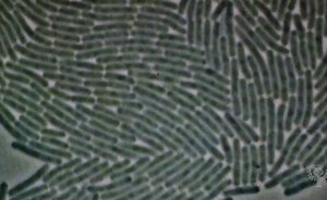 A Demonstration Of The Various Ways In Which Bacteria Is Reproduced