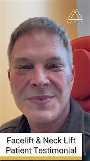 Dr. John Mesa on Instagram: "Just 12 days after his mid-facelift and neck lift, this patient is already seeing incredible results and his friends don’t even realize he had surgery. Here’s what stood out from his experience: • ✨ Other surgeons recommended fat transfer but he didn’t need it • 🎯 A tailored approach produced natural, refined results • 💉 Procedure performed under local anesthesia • ⚡ Faster healing and easier recovery • 👀 Results so natural that no one suspects a facelift • 🙌 “I’