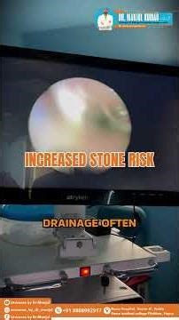 Double Ureter with Kidney Stone | Duplication of Ureter | PCNL Surgery Explained