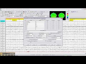 WinEEG education video Part 2
