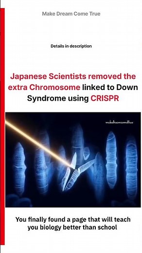 🧬 Japanese Scientists removed the 🧪 extra Chromosome using CRISPR 🧑🏻‍⚕️ | MDCT