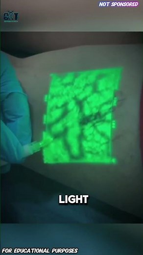 The Light That Reveals Your Veins — Vein Viewer Explained. #documentary#usashorts#fypシ