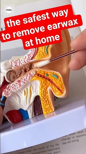 the safest way to remove earwax at home