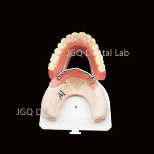 [Hot Item] Digital Dentures CAD Cam Implant Bar Titanium Dental Lab Price