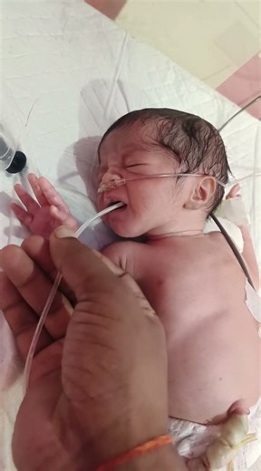 🩺 Newborn Baby Froth and Saliva from Mouth | Oral Suction Procedure in Newborn | Baby Care in NICU