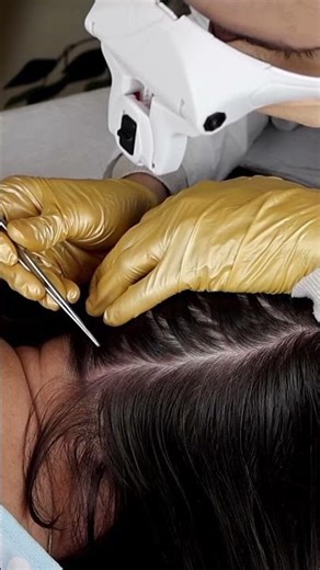 ASMR School Nurse LICE Check on Scalp and Neck | Lice Removal with a Comb and Tweezers #asmr #shorts