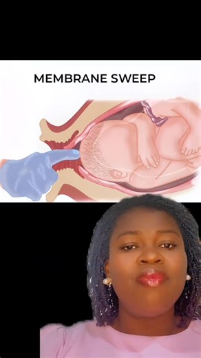 Tips on membrane sweeping for labor #membranesweeping #labour #forcelabour #childbirth #safemotherhood #midwifeanas @topfans @midwifeanastv | Midwife Anas TV
