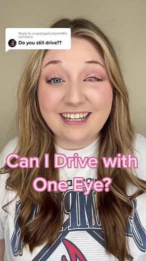 Driving with One Eye: My Experience & Tips