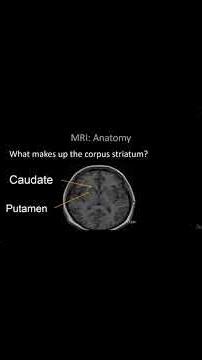 Top MRI Anatomy Landmarks You MUST Remember #anatomy #vip13 #healthtips #mri #shorts #healthtips