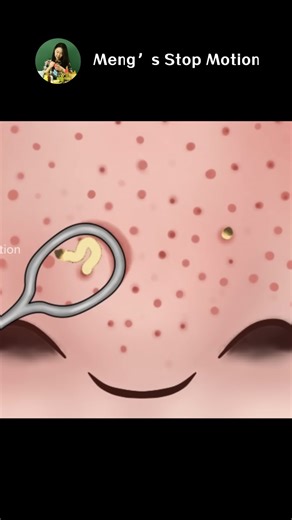53K views · 374 reactions | ASMR Animation居家臉部護理、去除黑頭 - Meng's Stop Motion #animation #healing #stressrelief #解壓 #reels | Meng's Stop Motion | Facebook