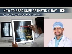 How to Read Knee joint X ray. How to read knee x ray report #kneexray