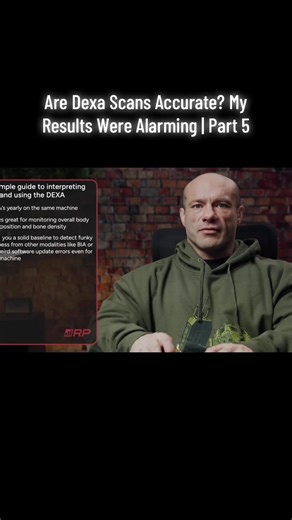 Are Dexa Scans Accurate? My Results Were Alarming | Part 5