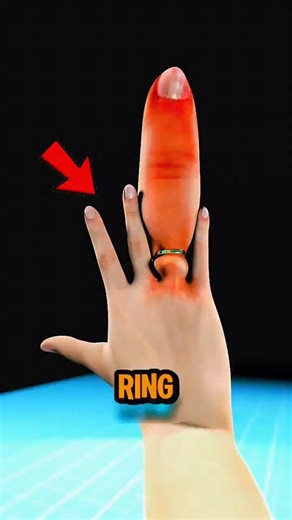 If Ring Won’t Come Off Don't Panic‼️😱